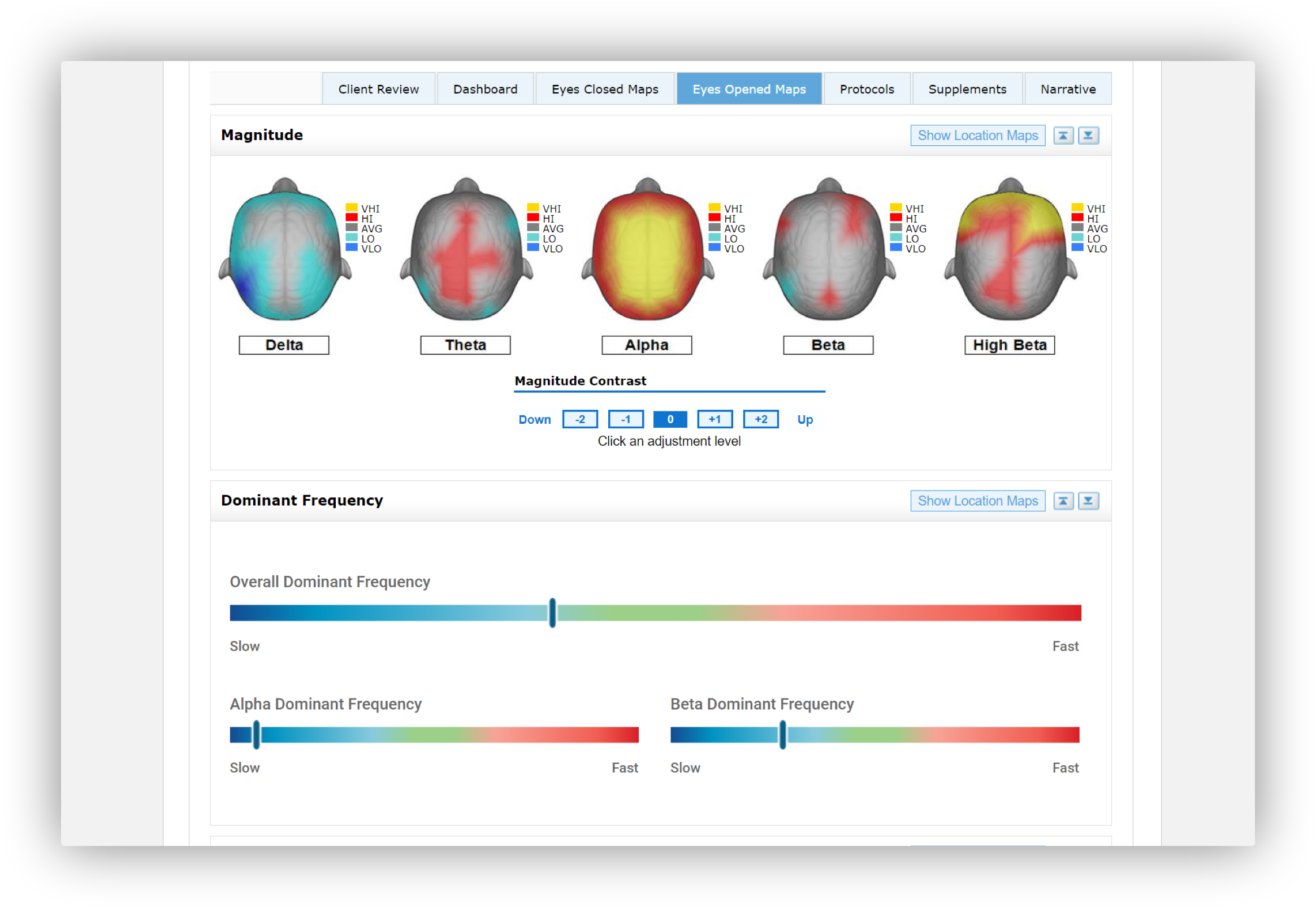 Integration with Eeg Assessment